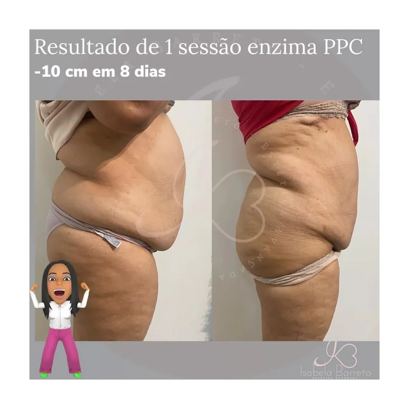 ibspot-44885269